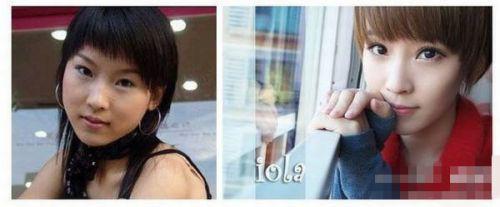 孙俪杨幂李小璐 女星出道前未整容雷人照吓死人