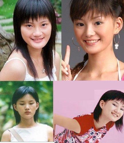 孙俪杨幂李小璐 女星出道前未整容雷人照吓死人