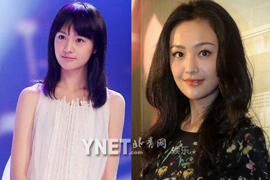 盘点娱圈整容变脸女明星