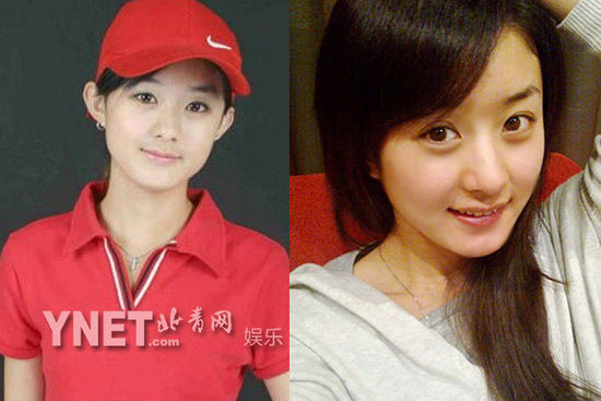 盘点娱圈整容变脸女明星