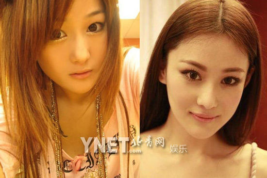 盘点娱圈整容变脸女明星