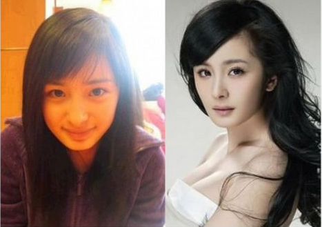 盘点娱圈整容变脸女明星