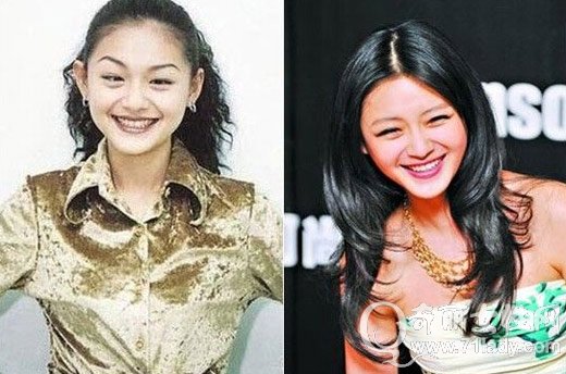 盘点娱圈整容变脸女明星