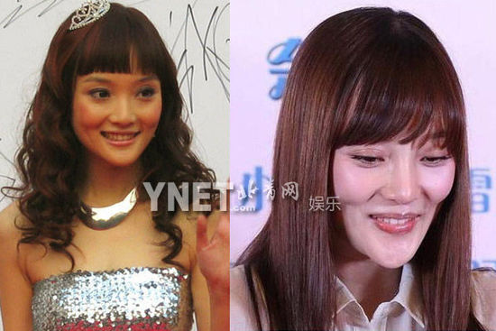 盘点娱圈整容变脸女明星