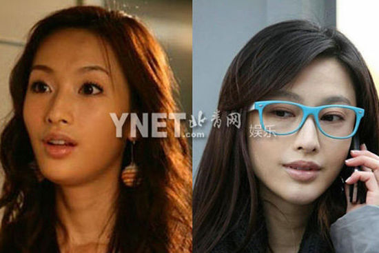 盘点娱圈整容变脸女明星