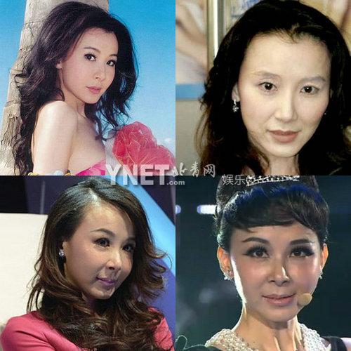盘点娱圈整容变脸女明星