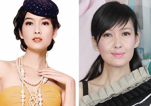 盘点娱圈整容变脸女明星