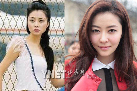 盘点娱圈整容变脸女明星