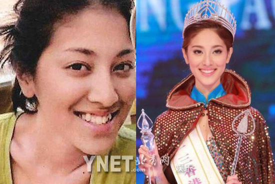 盘点娱圈整容变脸女明星