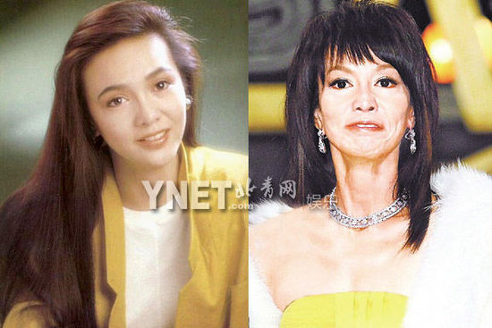 盘点娱圈整容变脸女明星