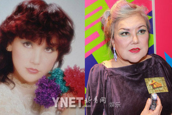 盘点娱圈整容变脸女明星