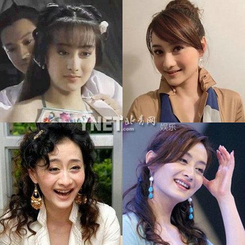 盘点娱圈整容变脸女明星