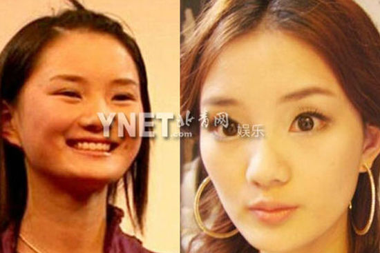 盘点娱圈整容变脸女明星