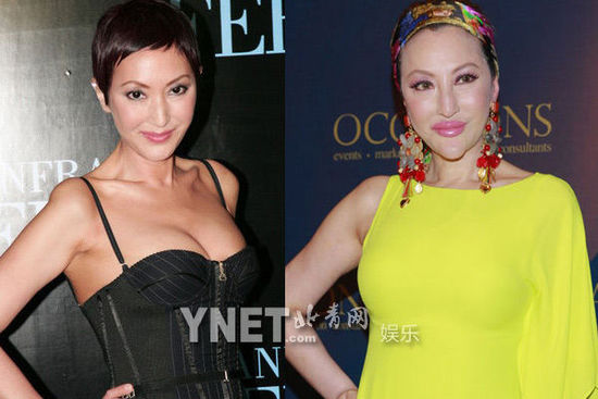 盘点娱圈整容变脸女明星