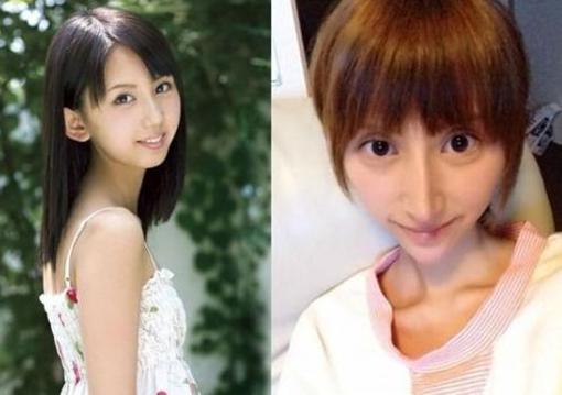 盘点娱圈整容变脸女明星