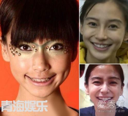 女星整容