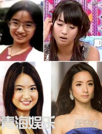 女星整容
