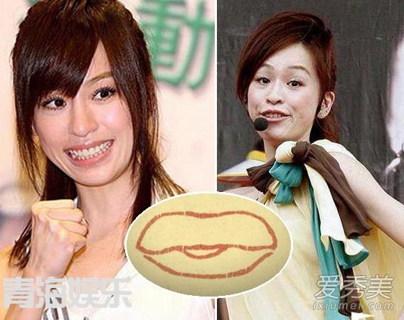 女星整容