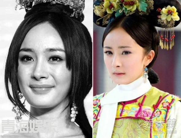 女星整容