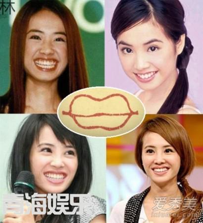 女星整容