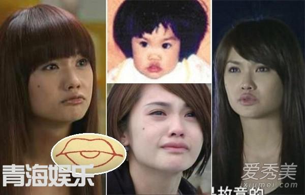 女星整容