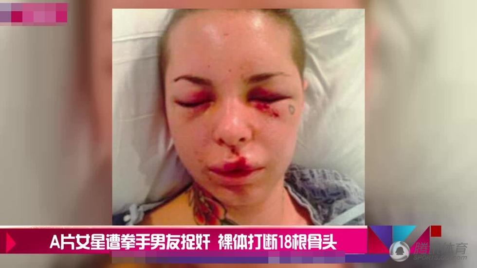 捉奸有图有真相！皮特曾偷情泰森妻子