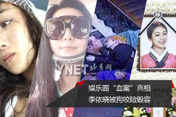 娱乐圈“血案”真相 李依晓被狗咬险毁容 娱乐圈“血案”真相 李依晓被狗咬险毁容