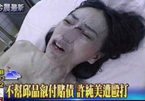 娱乐圈“血案”真相 李依晓被狗咬险毁容