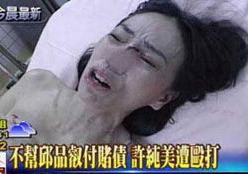 娱乐圈“血案”真相 李依晓被狗咬险毁容 娱乐圈“血案”真相 李依晓被狗咬险毁容
