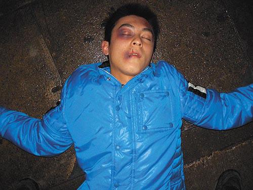 娱乐圈“血案”真相 李依晓被狗咬险毁容 娱乐圈“血案”真相 李依晓被狗咬险毁容