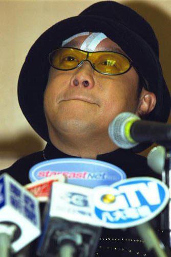 娱乐圈“血案”真相 李依晓被狗咬险毁容 娱乐圈“血案”真相 李依晓被狗咬险毁容