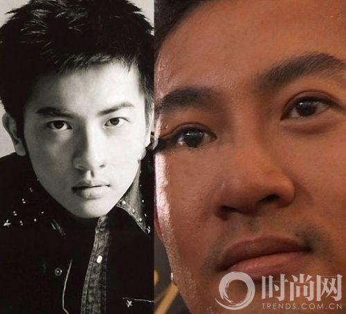 众男星整容秘史 罗志祥郭敬明超疯狂
