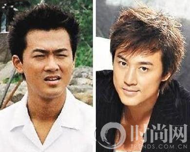 众男星整容秘史 罗志祥郭敬明超疯狂