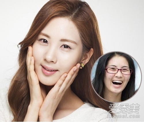 吴昕素颜示人吓死人 女星卸妆形象瞬间毁灭