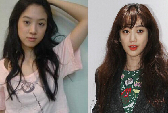 用力过猛反变残！女明星追赶潮流美颜变惊悚