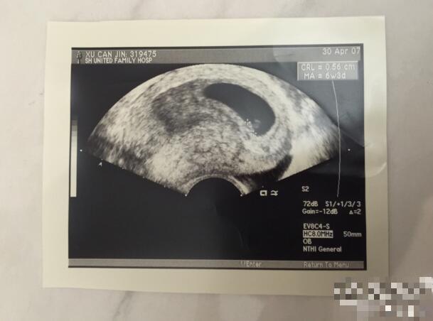 高晓松女儿八岁生日 前妻晒成长纪录 高晓松女儿八岁生日 前妻晒成长纪录