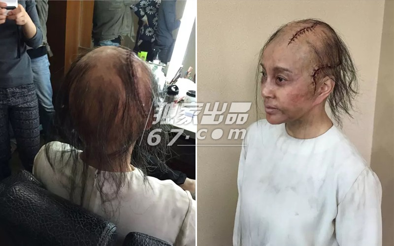 拒绝五毛钱特效！刘晓庆秃头顶骇人伤疤 吴君如变性