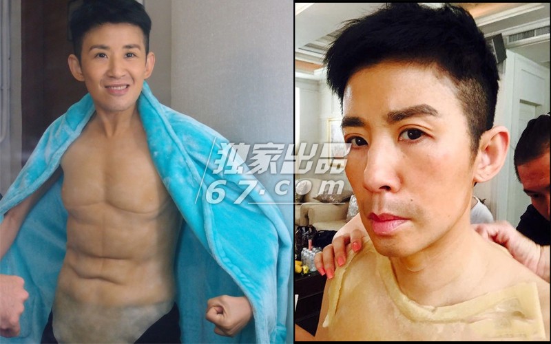 拒绝五毛钱特效！刘晓庆秃头顶骇人伤疤 吴君如变性