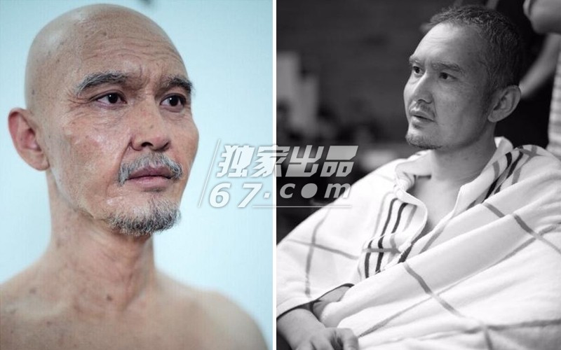 拒绝五毛钱特效！刘晓庆秃头顶骇人伤疤 吴君如变性