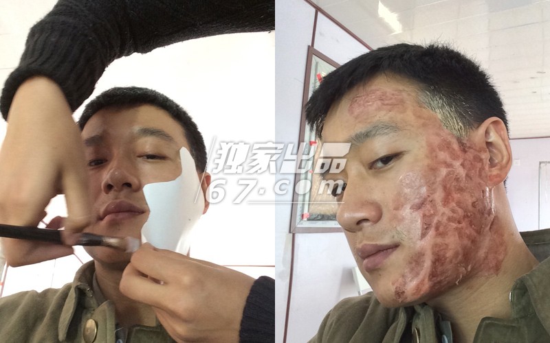 拒绝五毛钱特效！刘晓庆秃头顶骇人伤疤 吴君如变性