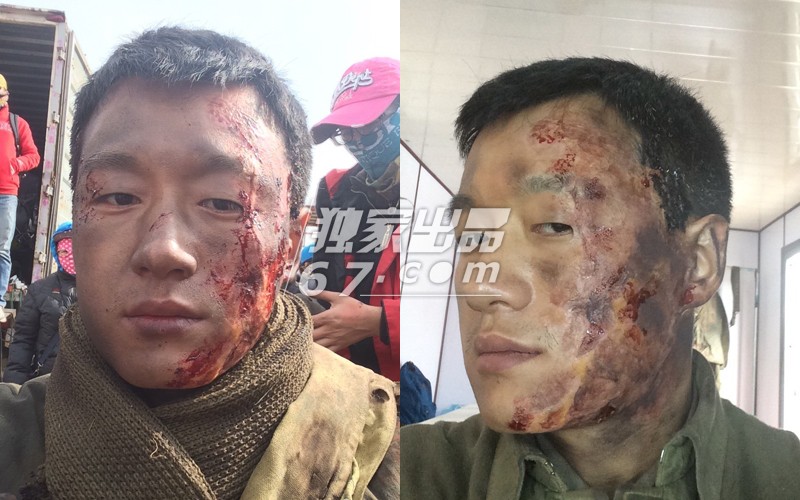 拒绝五毛钱特效！刘晓庆秃头顶骇人伤疤 吴君如变性