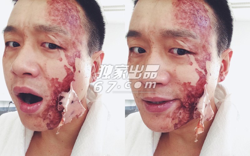 拒绝五毛钱特效！刘晓庆秃头顶骇人伤疤 吴君如变性