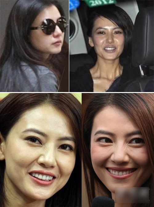 图揭30+女星面部真相