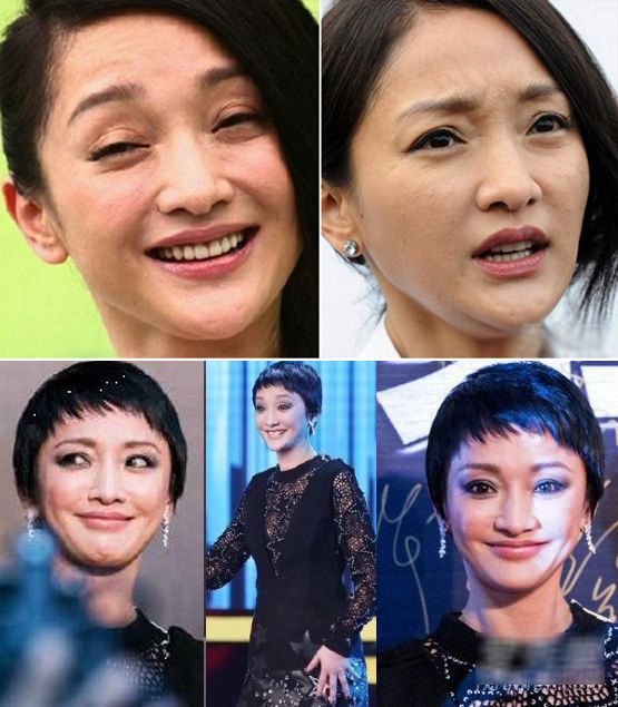 图揭30+女星面部真相