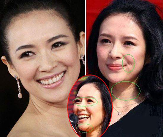 图揭30+女星面部真相