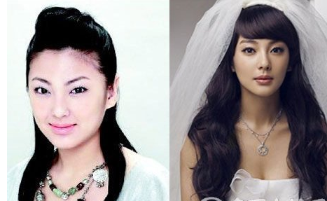 盘点娱圈整容变脸女明星